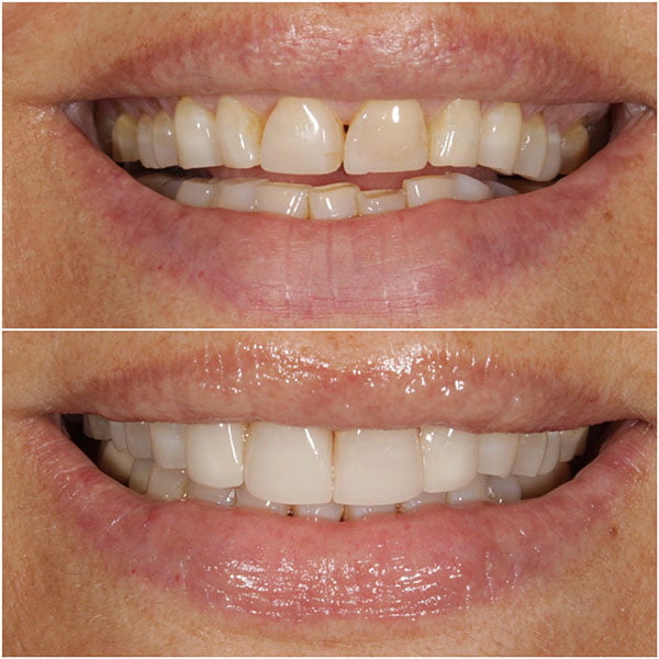 Smile Gallery Image