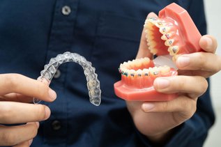 Invisalign aligners and braces
